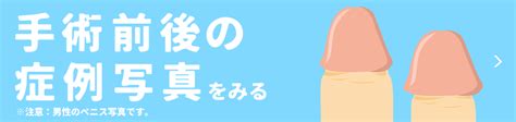 亀頭増大 写真|亀頭増大・強化｜症例写真｜名古屋中央クリニッ